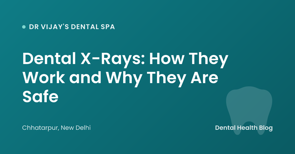 Dental X-Rays: How They Work and Why They Are Safe