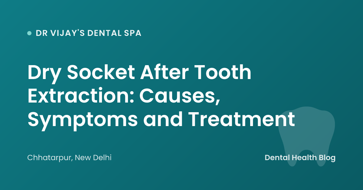 Dry Socket After Tooth Extraction: Causes, Symptoms and Treatment