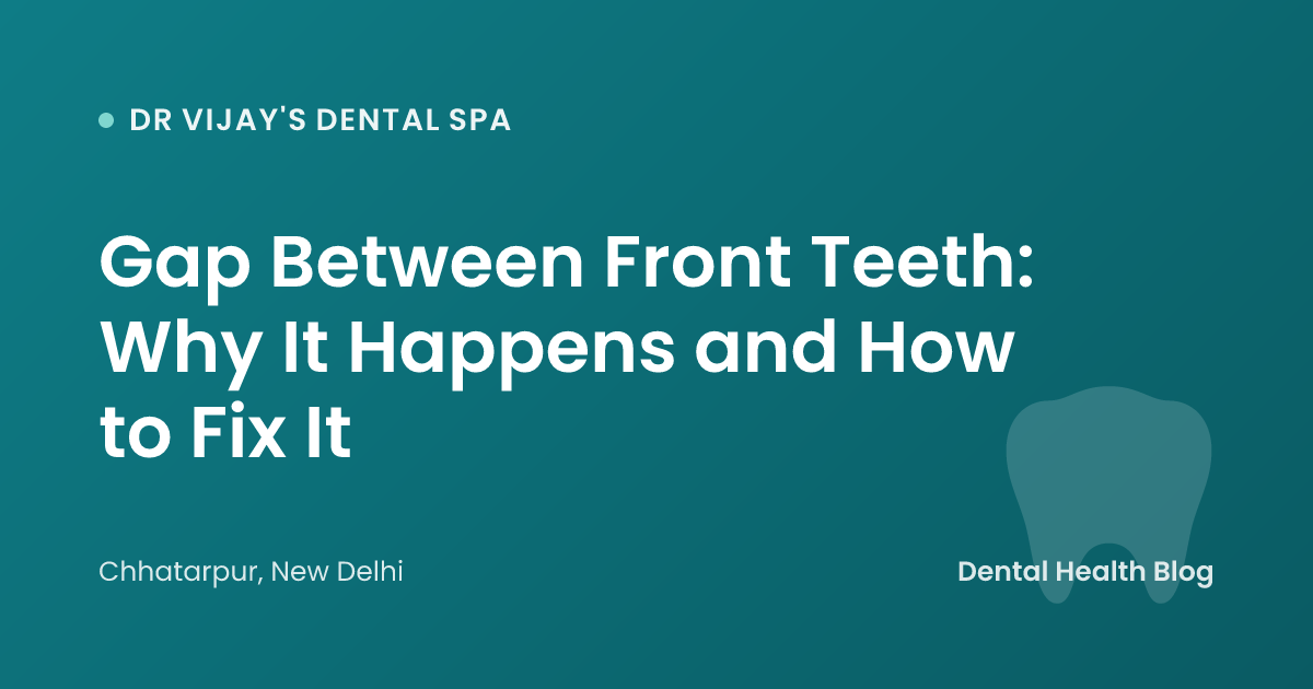Gap Between Front Teeth: Why It Happens and How to Fix It