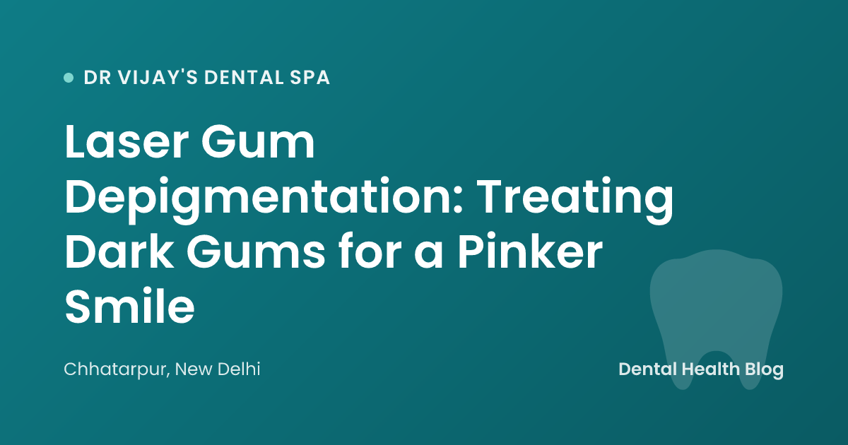 Laser Gum Depigmentation: Treating Dark Gums for a Pinker Smile