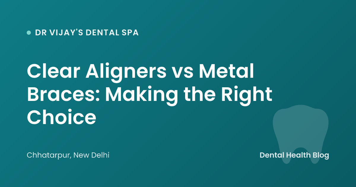 Clear Aligners vs Metal Braces: Making the Right Choice