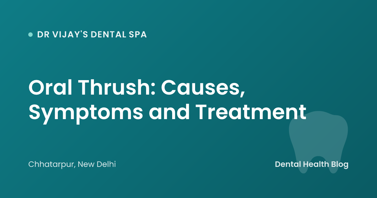 Oral Thrush: Causes, Symptoms and Treatment