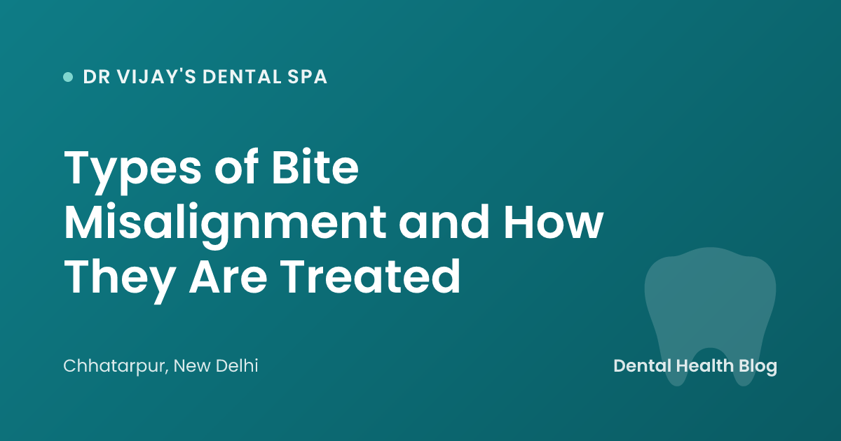 Types of Bite Misalignment and How They Are Treated