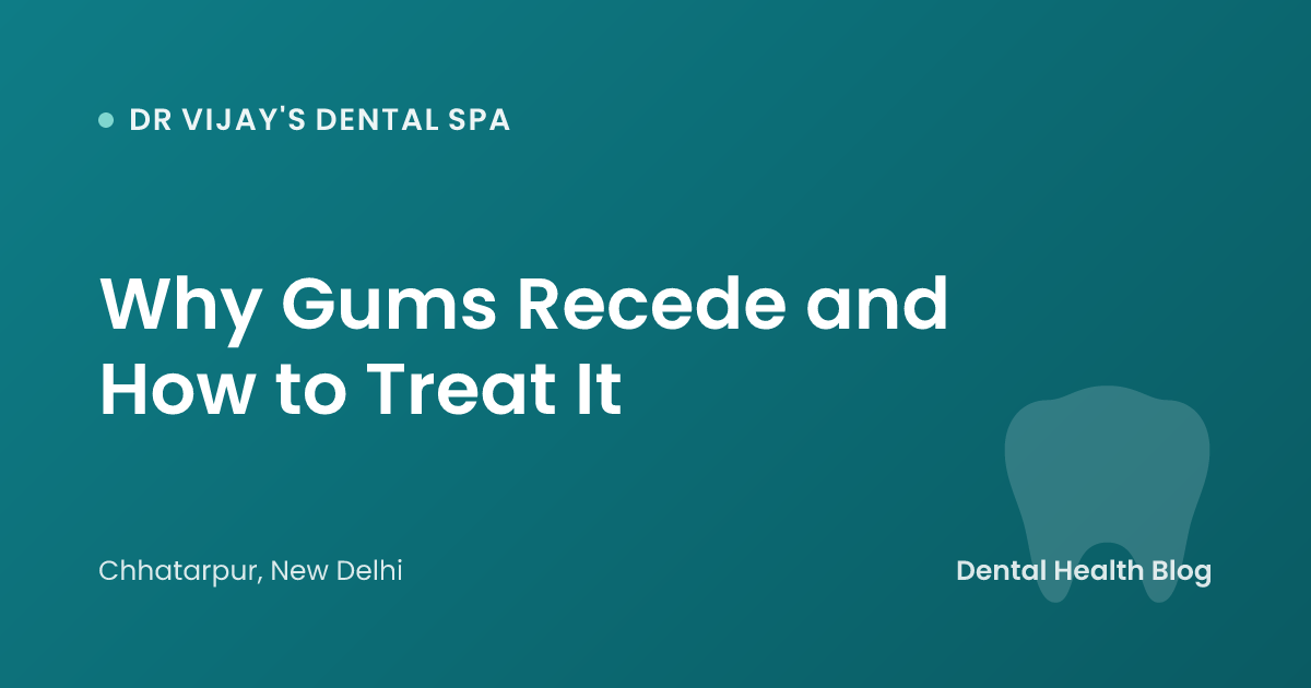 Why Gums Recede and How to Treat It