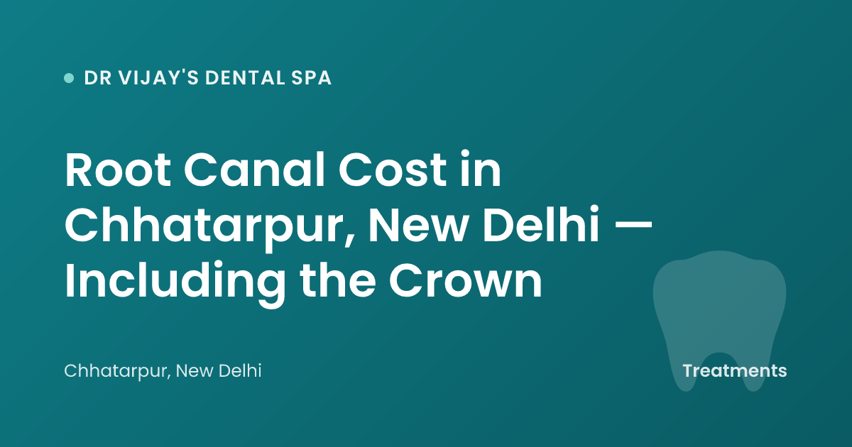 Root Canal Cost in Chhatarpur, New Delhi — Including the Crown
