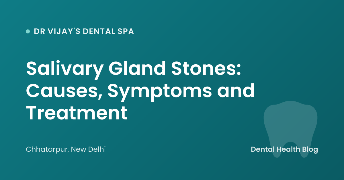 Salivary Gland Stones: Causes, Symptoms and Treatment