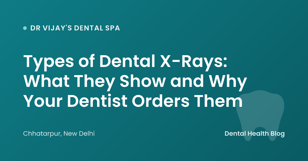 Types of Dental X-Rays: What They Show and Why Your Dentist Orders Them