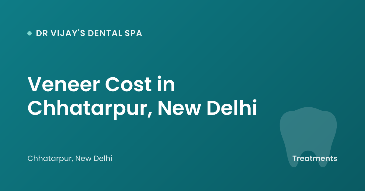 Veneer Cost in Chhatarpur, New Delhi