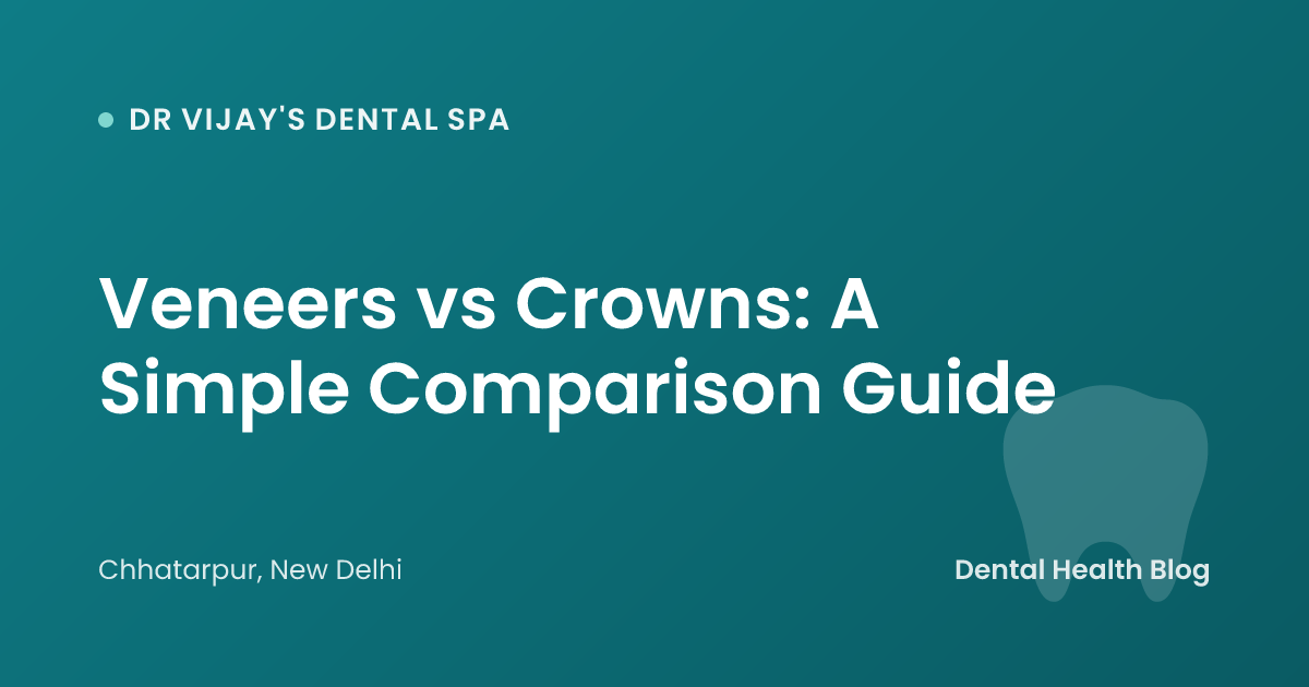 Veneers vs Crowns: A Simple Comparison Guide